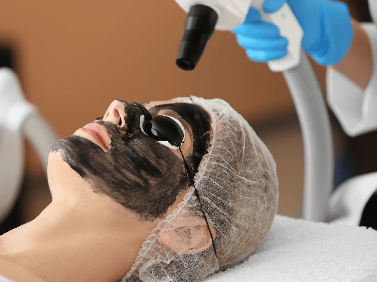 Peeling Hollywood Toledo